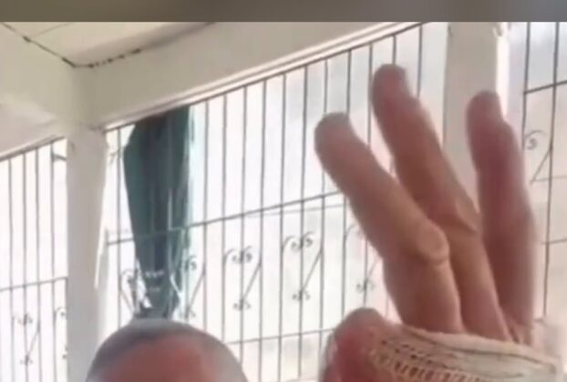 Homem afirma em vídeo que cortou o dedo mindinho após vitória de Lula na eleição